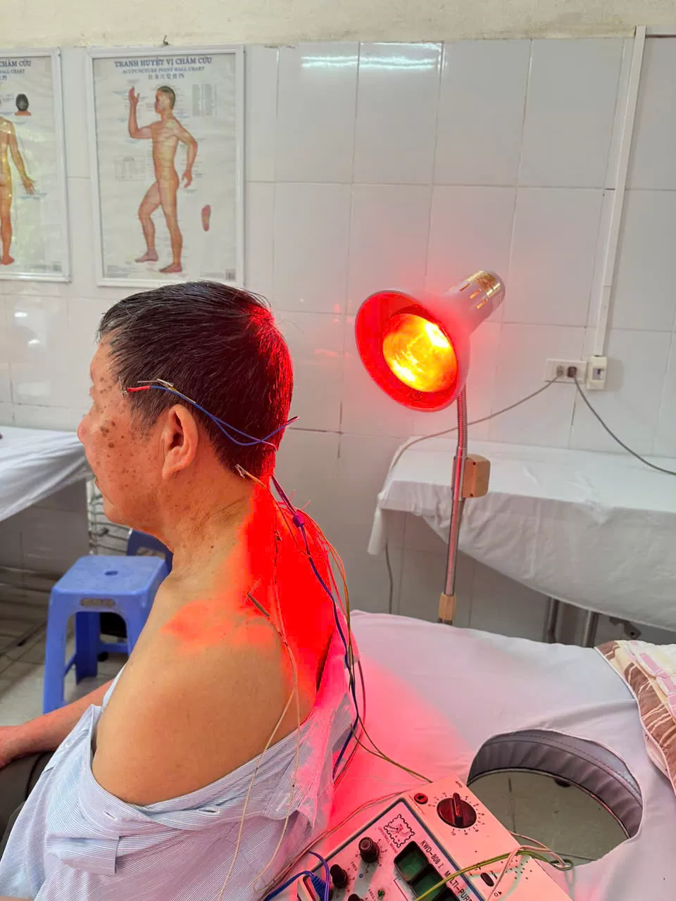 Trạm Y tế xã Ô Diên đẩy mạnh khám chữa bệnh bằng y học cổ truyền – Giải pháp an toàn, hiệu quả và bền vững cho sức khỏe