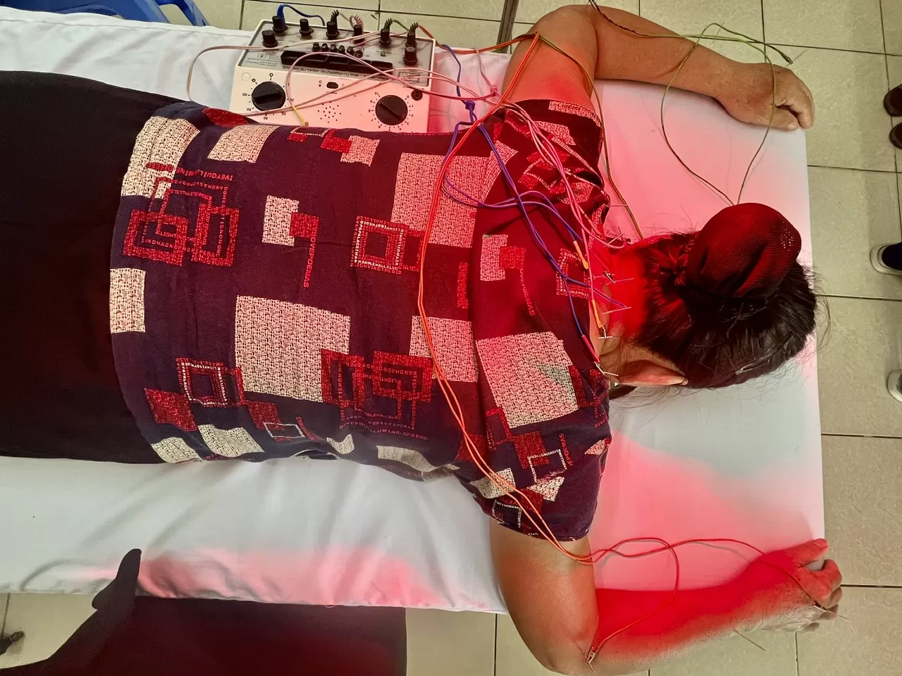 KHÁM CHỮA BỆNH Y HỌC CỔ TRUYỀN HÀNG NGÀY TẠI TRẠM Y TẾ Ô DIÊN