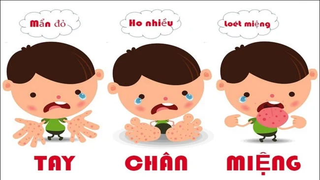 NHỮNG ĐIỀU CẦN BIẾT VỀ BỆNH TAY CHÂN MIỆNG VÀ CÁCH PHÒNG TRÁNH