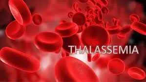 Hưởng ứng Ngày Thalassemia Thế giới (8/5/2025) với chủ đề “Chung tay vì Thalassemia – Đoàn kết cộng đồng, ưu tiên người bệnh”